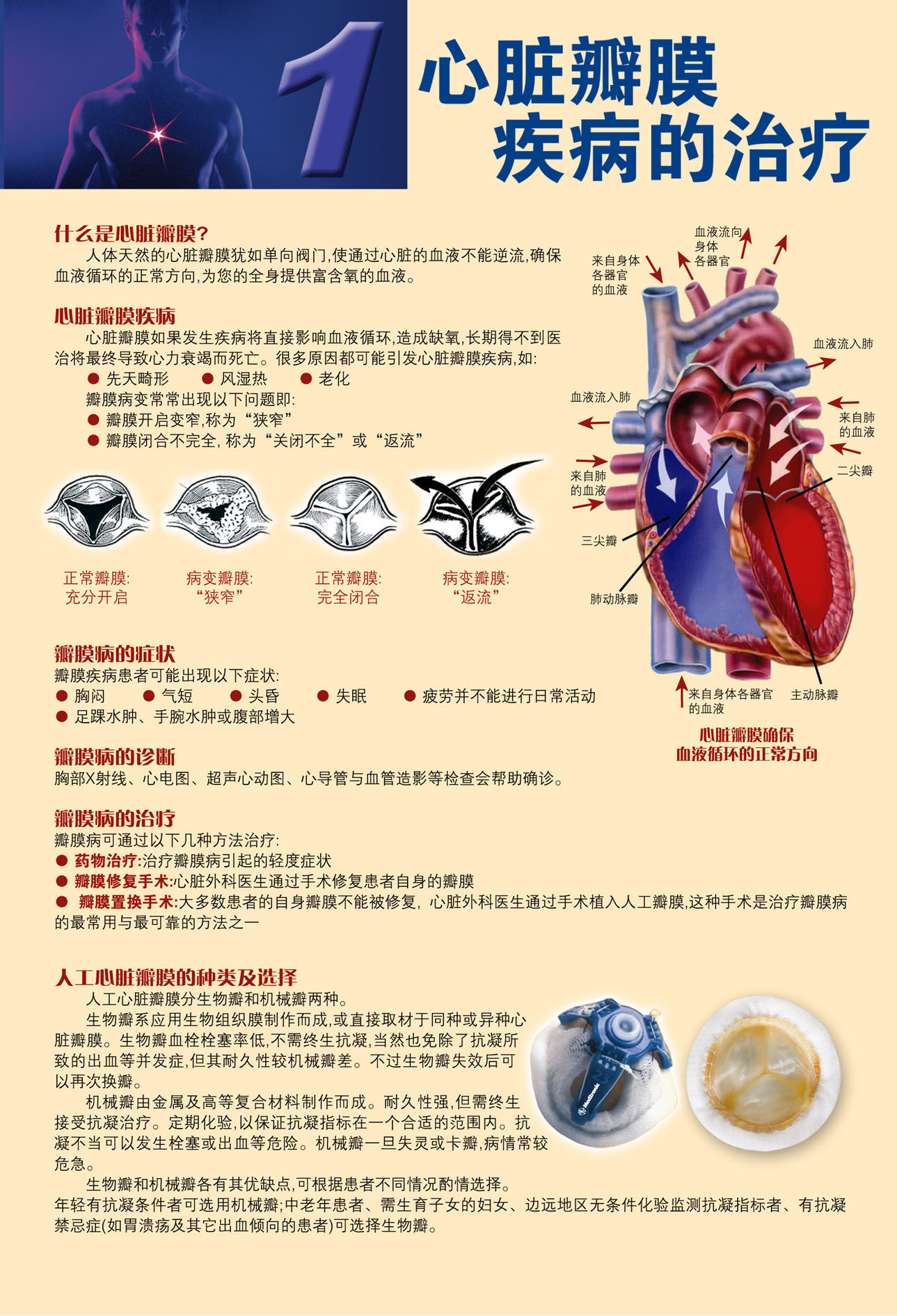 心脏瓣膜疾病 m.haodf.com