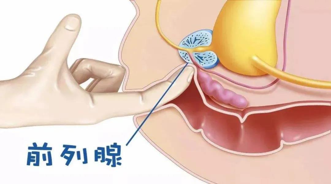 【前列无忧】前列腺 尿道球腺(深度)按摩治疗